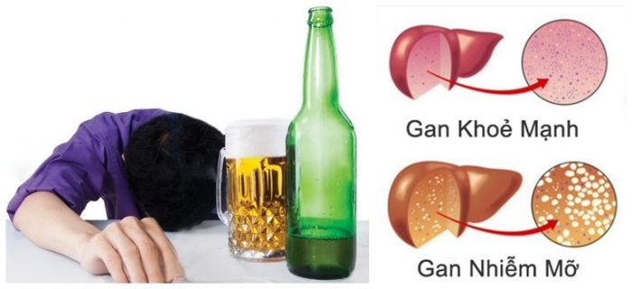 Tác hại khônh lường của bia, rượu 